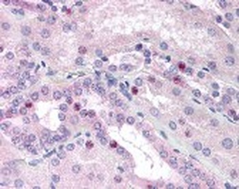 CEBPB Antibody