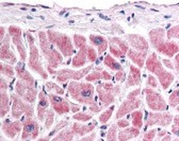 FZD7 Antibody
