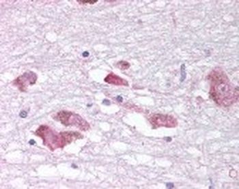 MCHR1 Antibody
