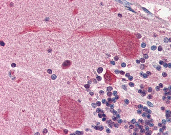 HSP90AA1 Antibody