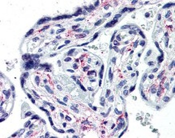 IL1R1 Antibody