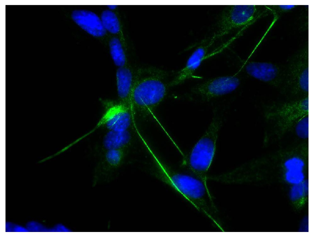 GFAP Antibody [SB61b]