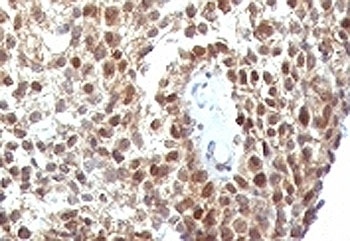 TP53 Antibody