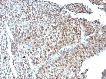 TP53 Antibody