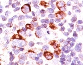 BCL2L1 Antibody