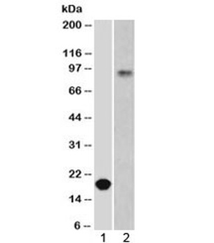 CDH1 Antibody