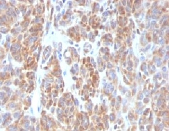 BCL2 Antibody