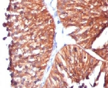 HSP60 Antibody [SRPR60]