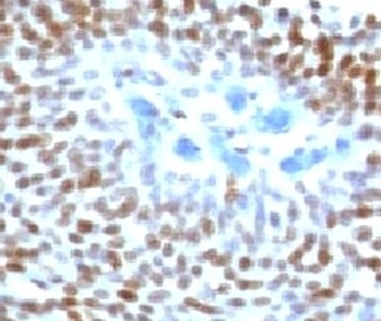 TP53 Antibody