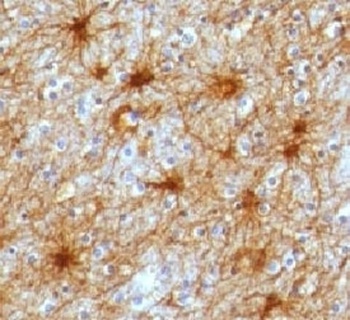 GFAP Antibody [GFA12-3]