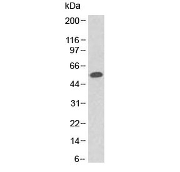 TP53 Antibody