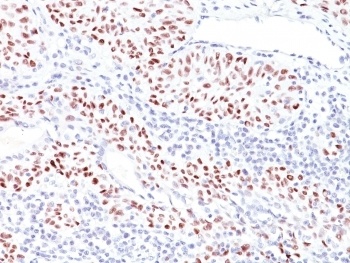 TP53 Antibody