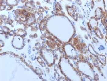 TSHR Antibody