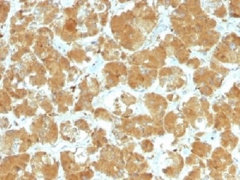 TSHR Antibody