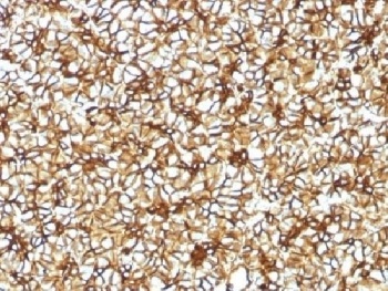 SPTBN2 Antibody