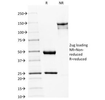 SPTBN2 Antibody