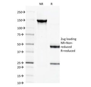 SPTBN2 Antibody