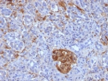 FTL Antibody