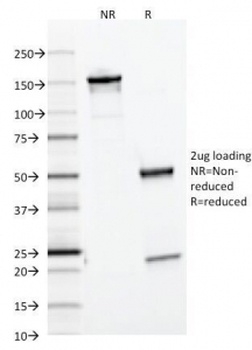 FTL Antibody