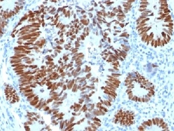 TP53 Antibody