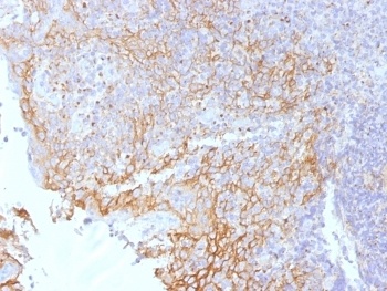 CTNNB1 Antibody