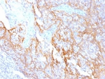 CTNNB1 Antibody