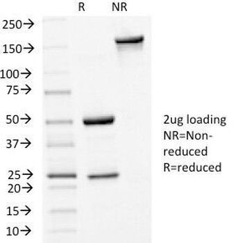 CDH1 Antibody
