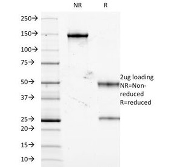 TNF Antibody