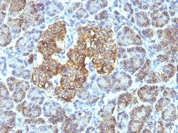 HSPD1 Antibody