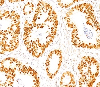 TP53 Antibody