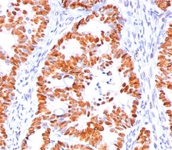 TP53 Antibody