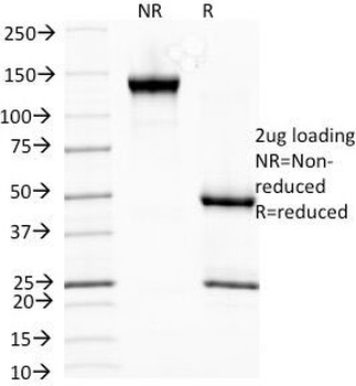 HSP27 Antibody [G3.1]