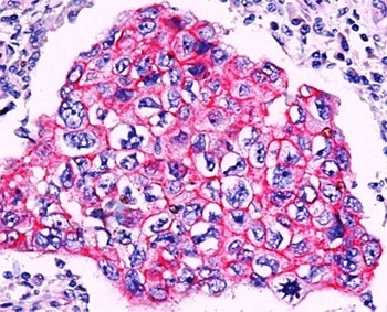 CTNNB1 Antibody