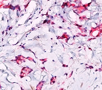 CTNNB1 Antibody