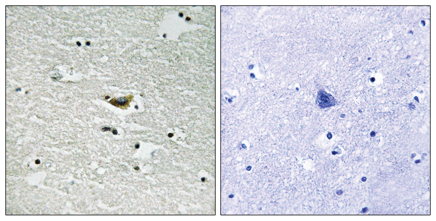 CSNK1A1, CSNK1A1L Antibody