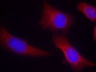 CAMK2N2 Antibody