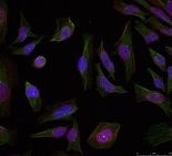 PGR Antibody