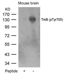 NTRK2 Antibody