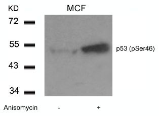 TP53 Antibody