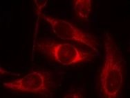 TP53 Antibody