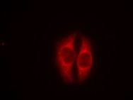 TP53 Antibody