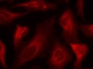 TP53 Antibody