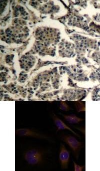 CFL1 CFL2 Antibody