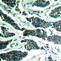 AKT1 AKT2 AKT3 Antibody