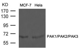 PAK1 PAK2 PAK3 Antibody