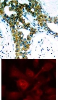 PAK1 PAK2 PAK3 Antibody