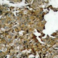 CFL1 Antibody
