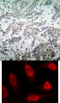 TP53 Antibody