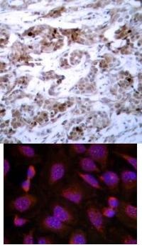 BCL2 Antibody