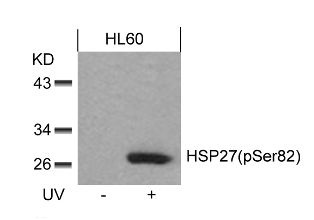 HSPB1 Antibody